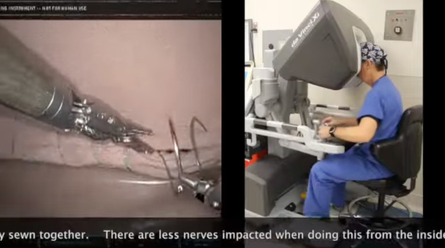 robotic surgery img2